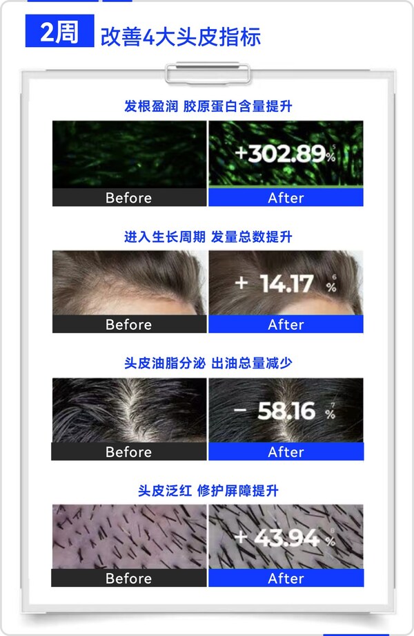 晶泰科技AI 研发平台开发的小分子Remeanagen™ 和多肽 AquaKine™联用配方改善头皮四大指标,有效固发防掉发 晶泰科技AI 研发平台开发的小分子Remeanagen™ 和多肽 AquaKine™联用配方改善头皮四大指标,有效固发防掉发