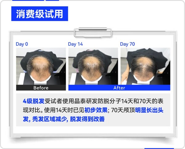 晶泰科技 AI 研发生发分子消费级试用效果案例 晶泰科技 AI 研发生发分子消费级试用效果案例