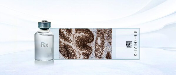 VENTANA CLDN18伴随诊断检测试剂