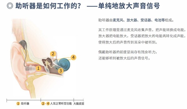 助听器工作原理 助听器工作原理